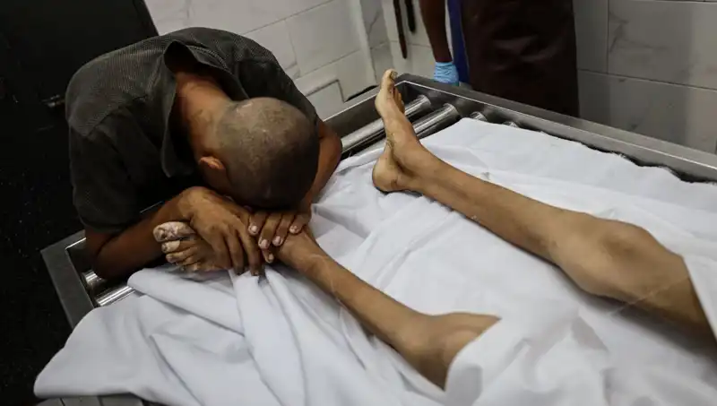 Gazze'de Açlık Çığlığı: Bir Çocuk Daha Hayata Veda Etti