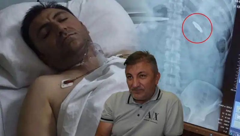 15 Temmuz’un Unutulmayan Yarası: 9 Yıldır Kurşunla Yaşamak